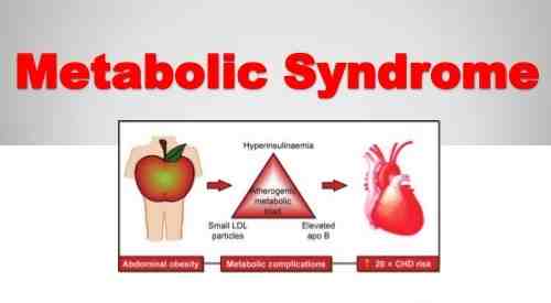 Metabolik Sendrom-Obezite